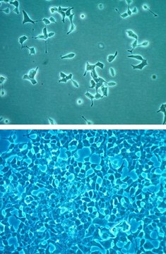 INS-1 832/13大鼠胰岛素瘤细胞系 INS-1 832/13 rat insulinoma cell line is a useful model for insulin secretion regulation and pancreatic islet beta-cell function studies.