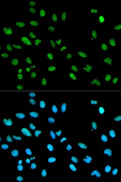 Anti-RBBP4 antibody produced in rabbit