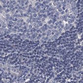 Anti-RTKN2 antibody produced in rabbit Prestige Antibodies® Powered by Atlas Antibodies, affinity isolated antibody, buffered aqueous glycerol solution