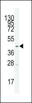 ANTI-MCT1 (SLC16A1) (CENTER) antibody produced in rabbit purified immunoglobulin, buffered aqueous solution