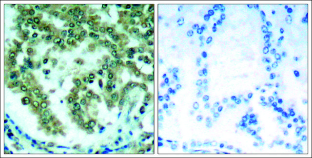 Anti-PRKCQ (Ab-676) antibody produced in rabbit affinity isolated antibody