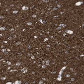 Anti-ATP2B1 antibody produced in rabbit Prestige Antibodies® Powered by Atlas Antibodies, affinity isolated antibody, buffered aqueous glycerol solution