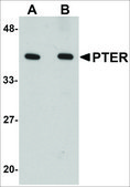 Anti-PTER antibody produced in rabbit affinity isolated antibody, buffered aqueous solution