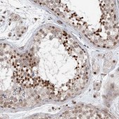 Anti-SDE2 antibody produced in rabbit Prestige Antibodies® Powered by Atlas Antibodies, affinity isolated antibody, buffered aqueous glycerol solution, ab2