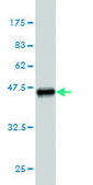 Monoclonal Anti-SGKL, (N-terminal) antibody produced in mouse clone 2A7, purified immunoglobulin, buffered aqueous solution