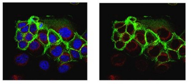 Anti-Epithelial Specific Antigen Antibody, clone VU-1D9 clone VU-1D9, from mouse