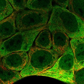 Anti-SCNN1G antibody produced in rabbit Prestige Antibodies&#174; Powered by Atlas Antibodies, affinity isolated antibody