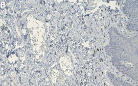 Anti-Elastin Antibody, clone 10B8 ZooMAb&#174; Mouse Monoclonal recombinant, expressed in HEK 293 cells