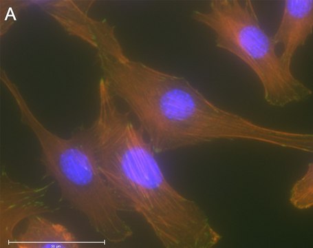 Anti-p-Paxillin-Tyr118 Antibody, clone 1E19 ZooMAb&#174; Rabbit Monoclonal recombinant, expressed in HEK 293 cells