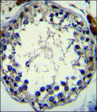 ANTI-STRA8 (C-TERM) antibody produced in rabbit IgG fraction of antiserum, buffered aqueous solution