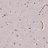 Anti-SLC4A1 antibody produced in rabbit Prestige Antibodies® Powered by Atlas Antibodies, affinity isolated antibody, buffered aqueous glycerol solution