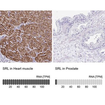 Anti-SRL antibody produced in rabbit Prestige Antibodies&#174; Powered by Atlas Antibodies, affinity isolated antibody, buffered aqueous glycerol solution