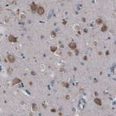 Monoclonal Anti-GORASP2 antibody produced in mouse Prestige Antibodies® Powered by Atlas Antibodies, clone CL2522, purified immunoglobulin, buffered aqueous glycerol solution