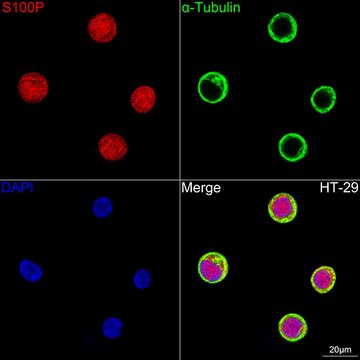 Anti-S100P Antibody, clone 1E1M2, Rabbit Monoclonal