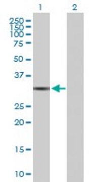 Anti-QPRT antibody produced in rabbit purified immunoglobulin, buffered aqueous solution