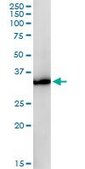 Monoclonal Anti-GPD1 antibody produced in mouse clone 3C10-1C4, purified immunoglobulin, buffered aqueous solution