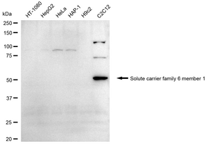 Anti Solute Carrier Family 6 Member 1 Antibody, clone 24GB2390, Rabbit Monoclonal clone 24GB2390, recombinant rabbit monoclonal, expressed in HEK293 cells