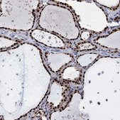 Anti-TSEN34 antibody produced in rabbit Prestige Antibodies® Powered by Atlas Antibodies, affinity isolated antibody, buffered aqueous glycerol solution