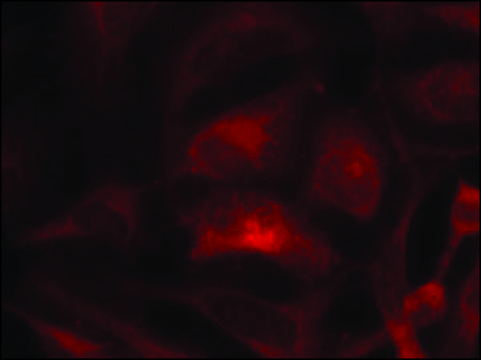 Anti-RAC1 (Ab-71) antibody produced in rabbit affinity isolated antibody