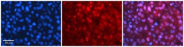 Anti-MBD2 antibody produced in rabbit affinity isolated antibody