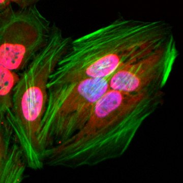 Anti-Acetylated-Lysine antibody, Rabbit monoclonal recombinant, expressed in HEK 293 cells, clone RM101, purified immunoglobulin