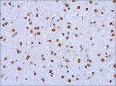 单克隆抗 5-甲基胞嘧啶/5-mC 小鼠抗 clone GT4111, affinity isolated antibody