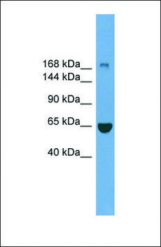 Anti-ZCCHC11 antibody produced in rabbit affinity isolated antibody