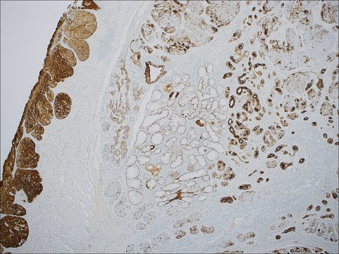 Cytokeratin 5 &amp; 6 (EP24 &amp; EP67) Rabbit Monoclonal Primary Antibody