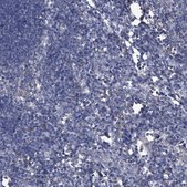 Anti-PCSK5 antibody produced in rabbit Prestige Antibodies® Powered by Atlas Antibodies, affinity isolated antibody, buffered aqueous glycerol solution