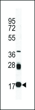 MONOCLONAL ANTI-UBC9 antibody produced in mouse clone 67AT1273.95.90, IgG fraction of antiserum, buffered aqueous solution