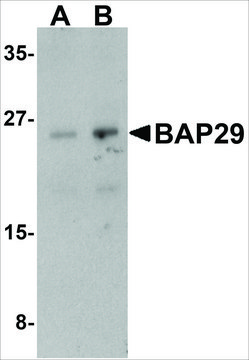 Anti-BAP29 (ab2) antibody produced in rabbit affinity isolated antibody, buffered aqueous solution