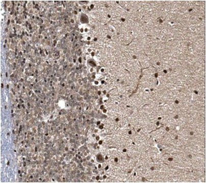 Anti-CAPS-2 Antibody from rabbit, purified by affinity chromatography