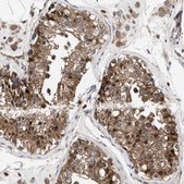 Anti-TP53I3 antibody produced in rabbit Prestige Antibodies® Powered by Atlas Antibodies, affinity isolated antibody, buffered aqueous glycerol solution