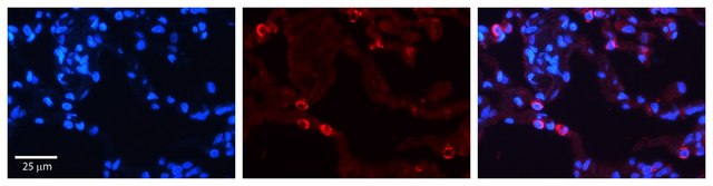 Anti-P4HB (AB2) antibody produced in rabbit affinity isolated antibody