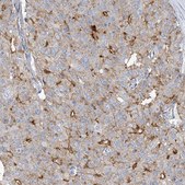 Anti-ADCK2 antibody produced in rabbit Prestige Antibodies® Powered by Atlas Antibodies, affinity isolated antibody, buffered aqueous glycerol solution