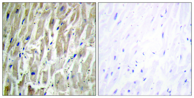 Anti-Cytochrome P450 2J2 antibody produced in rabbit affinity isolated antibody