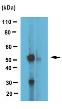 Anti-alpha Tubulin Antibody, tyrosinated serum, from rabbit