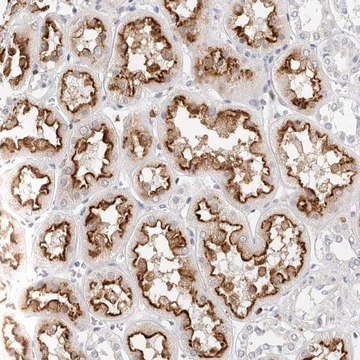 Anti-TMEM63B antibody produced in rabbit Prestige Antibodies&#174; Powered by Atlas Antibodies, affinity isolated antibody, buffered aqueous glycerol solution