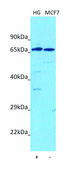 Anti-TM6SF2 (C-terminal) antibody produced in rabbit affinity isolated antibody