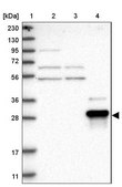Anti-ZNF397 antibody produced in rabbit Prestige Antibodies® Powered by Atlas Antibodies, affinity isolated antibody, buffered aqueous glycerol solution