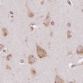 Anti-RPN1 antibody produced in rabbit Prestige Antibodies® Powered by Atlas Antibodies, affinity isolated antibody