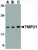Anti-TMP21 (ab1) antibody produced in rabbit affinity isolated antibody, buffered aqueous solution