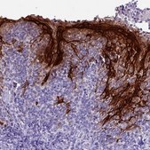 Anti-KRT6A antibody produced in rabbit Prestige Antibodies® Powered by Atlas Antibodies, affinity isolated antibody, buffered aqueous glycerol solution