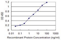 Monoclonal Anti-ATP2A1 antibody produced in mouse clone 6F8, purified immunoglobulin, buffered aqueous solution