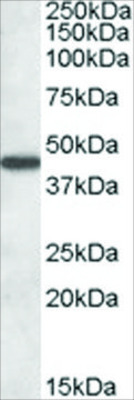 Anti-AADAT antibody produced in goat affinity isolated antibody, buffered aqueous solution