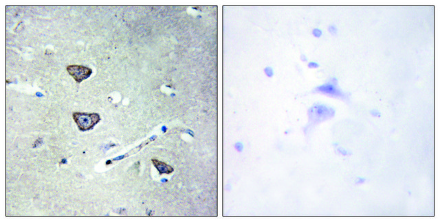 Anti-5-HT-2C antibody produced in rabbit affinity isolated antibody