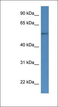 Anti-CYP51A1 antibody produced in rabbit affinity isolated antibody