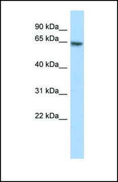 Anti-PAX7 antibody produced in rabbit affinity isolated antibody