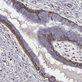 Anti-BDKRB1 antibody produced in rabbit Prestige Antibodies® Powered by Atlas Antibodies, affinity isolated antibody, buffered aqueous glycerol solution