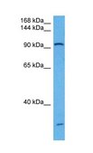Anti-UBE3A (ab1) antibody produced in rabbit affinity isolated antibody